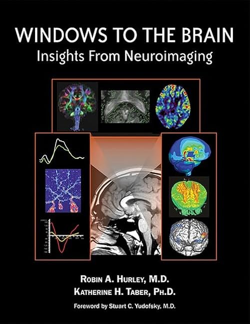 medical/neurology/windows-to-the-brain-insights-from-neuroimaging-9781585623020
