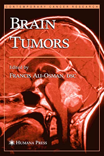 medical/neurology/brain-tumors-9781588290427