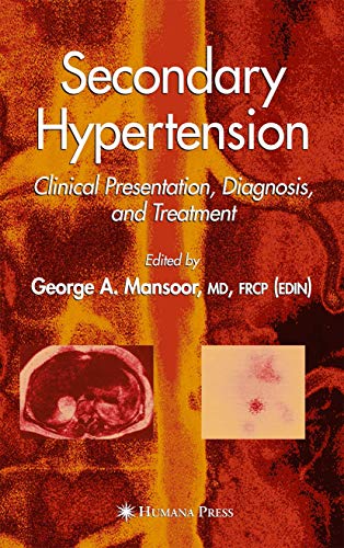 medical/cardiology/secondary-hypertension-clinical-presentation-diagnosis-and-treatment-9781588291417