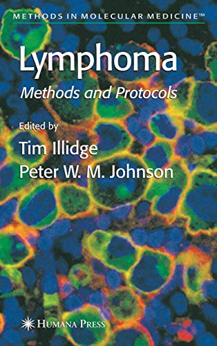 medical/oncology/lymphoma-methods-in-molecular-medicine-vol-115-9781588291592