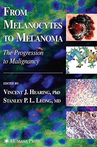 medical/pathology/from-melanocytes-to-melanoma-the-progression-to-malignancy-9781588294593