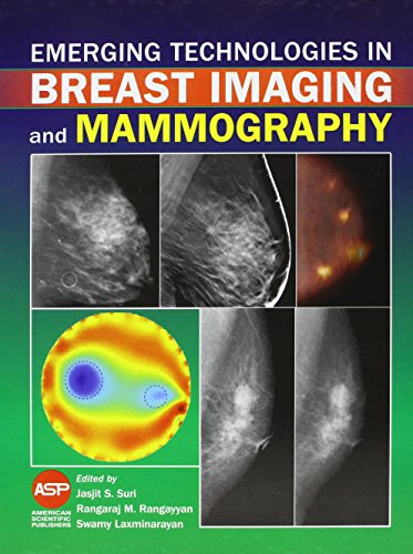 medical/radiology/emerging-technologies-in-breast-imaging-and-mammography-9781588830906