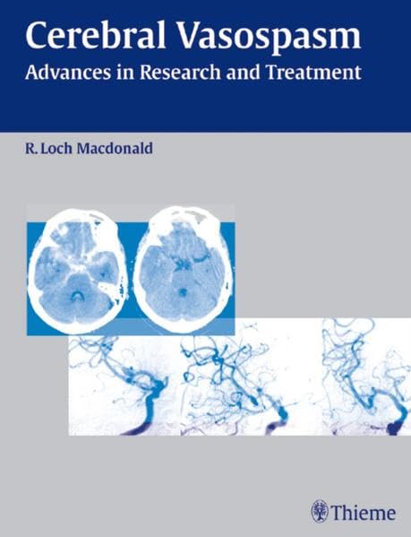 medical/neurology/cerebral-vasospasm-advances-in-research-and-treatment-1-e-9781588902832