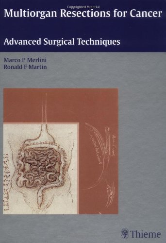 medical/oncology/multiorgan-resections-for-cancer-advanced-surgical-techniques-9781588903549