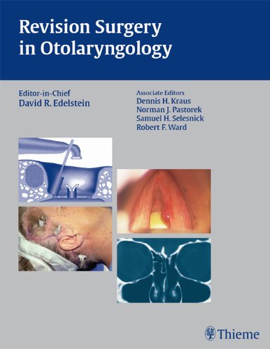exclusive/otolaryngology/revision-surgery-in-otolaryngology-9781588903693