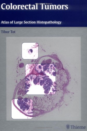 medical/pathology/colorectal-tumors-atlas-of-large-section-histopathology-9781588903846
