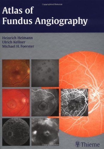 medical/ophthalmology/atlas-of-fundus-angiography-9781588904386