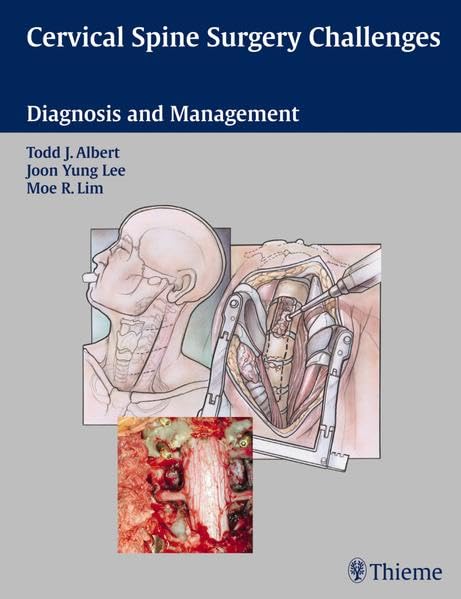 medical/neurology/cervical-spine-surgery-challenges-diagnosis-and-management-1-e-9781588904942