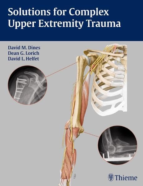 SOLUTIONS FOR COMPLEX UPPER EXTREMITY TRAUMA