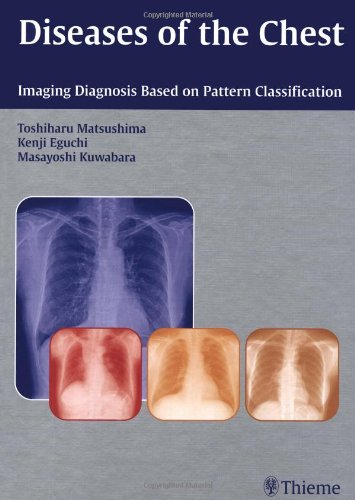 medical/respiratory-medicine/diseases-of-the-chest-imaging-diagnosis-based-on-pattern-classification-9781588905628
