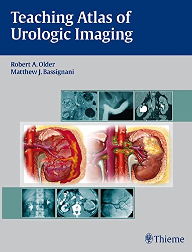 TEACHING ATLAS OF UROLOGIC IMAGING