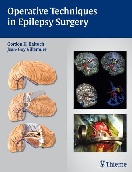 medical/neurology/operative-techniques-in-epilepsy-surgery--9781604060300