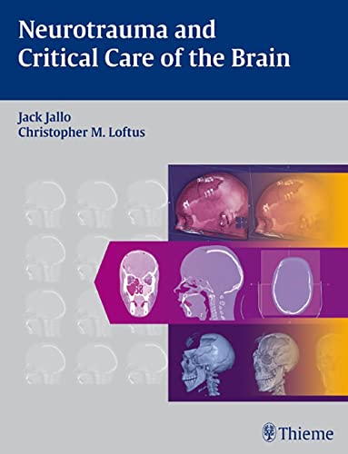 medical/neurology/neurotrauma-and-critical-care-of-the-brain-9781604060324