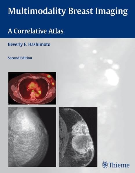 MULTIMODALITY BREAST IMAGING