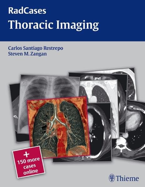 RADCASES THORACIC IMAGING