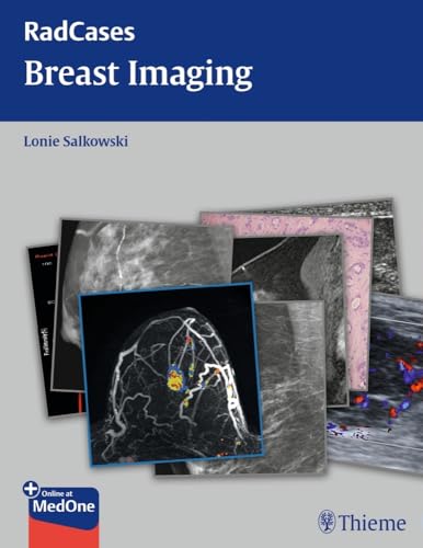 RADCASES BREAST IMAGING