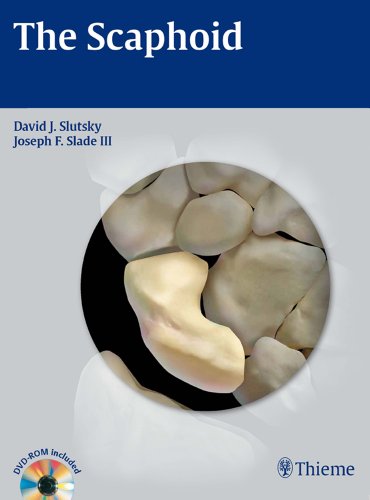 exclusive/orthopaedics/the-scaphoid-9781604062373