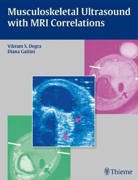 medical/radiology/musculoskeletal-ultrasound-with-mri-correlations-1-e-9781604062441