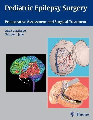 PEDIATRIC EPILEPSY SURGERY: PREOPERATIVE ASSESSMENT AND SURGICAL TREATMENT: 1/E medical/neuro-surgery/pediatric-epilepsy-surgery-preoperative-assessment-and-surgical-treatment-1-e-9781604062540