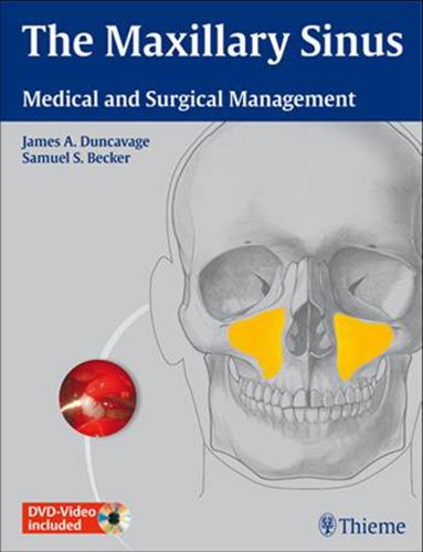 THE MAXILLARY SINUS