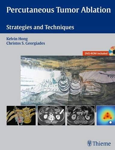 exclusive/oncology/percutaneous-tumor-ablation-strategies-and-techniques-9781604063066