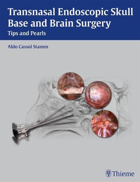TRANSNASAL ENDOSCOPIC SKULL & BRAIN SURGERY