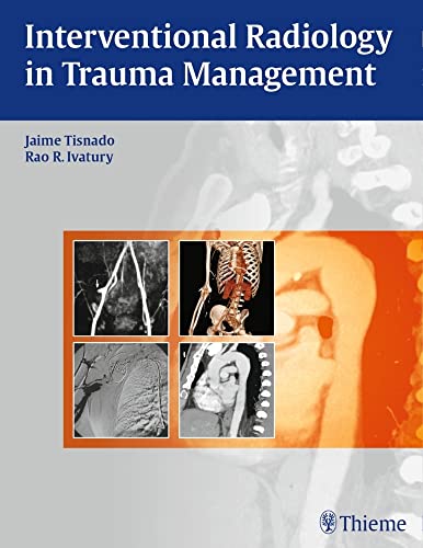 medical/radiology/interventional-radiology-in-trauma-1-e-9781604063110