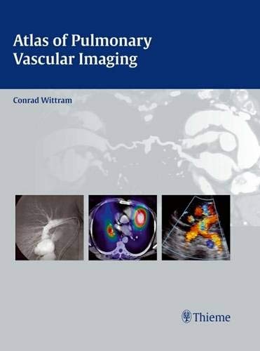 ATLAS OF PULMONARY VASCULAR IMAGING