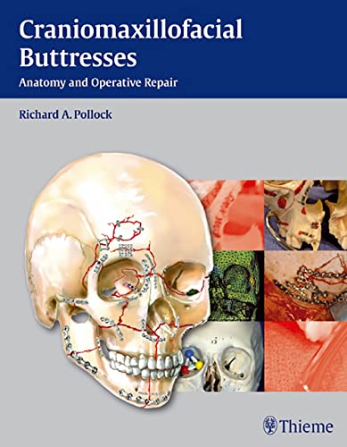 CRANIOMAXILLOFACIAL BUTTRESSES