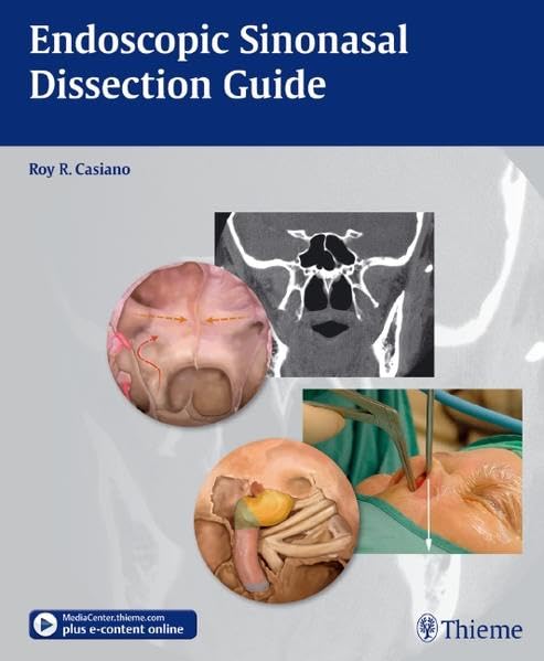 medical/otolaryngology/endoscopic-sinonasal-dissection-guide-pb--9781604065879