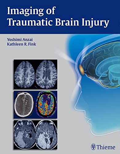 medical/neurology/imaging-of-traumatic-brain-injury-1-e-9781604067286