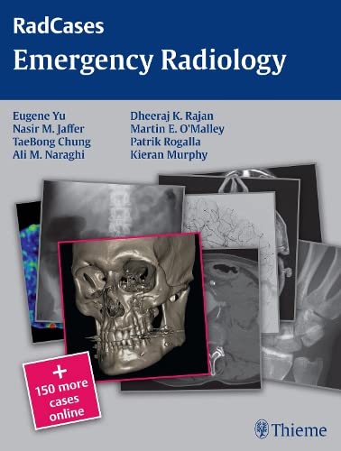 RADCASES EMERGENCY RADIOLOGY: 1/E medical/radiology/radcases-emergency-radiology-1-e-9781604068320