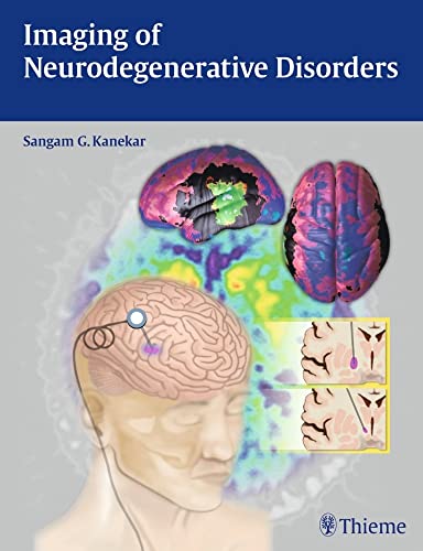 medical/radiology/imaging-of-neurodegenerative-disorders-1-e-9781604068542