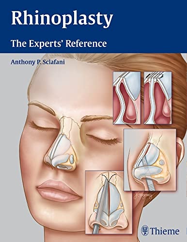 medical/otolaryngology/rhinoplasty-the-experts-reference-1-e-9781604068672