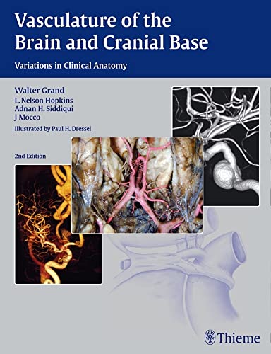 medical/neurology/vasculature-of-the-brain-and-cranial-base--9781604068856