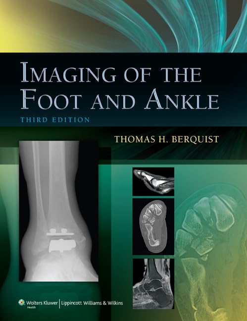 medical/orthopaedics/imaging-of-the-foot-and-ankle-9781605475721