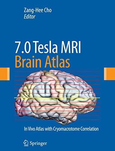 medical/neurology/7-0-tesla-mri-brain-atlas-in-vivo-atlas-with-cryomacrotome-correlation-9781607611530