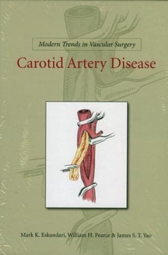 medical/cardiac-surgery/carotid-artery-disease-modern-trends-in-vascular-surgery-9781607950523