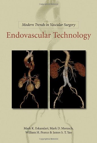 medical/cardiac-surgery/modern-trends-in-vascular-surgery-endovascular-technology-9781607950530