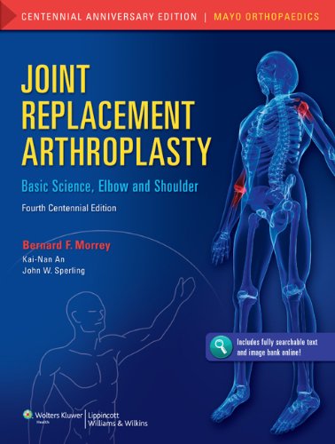 medical/orthopaedics/joint-replacement-arthroplasty-9781608314676