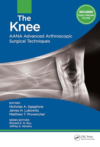 technical/general/the-knee-9781617119996