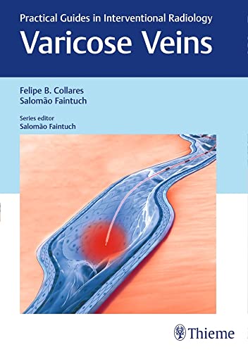 medical/radiology/varicose-veins-practical-guides-in-interventional-radiology-1-e-9781626230125