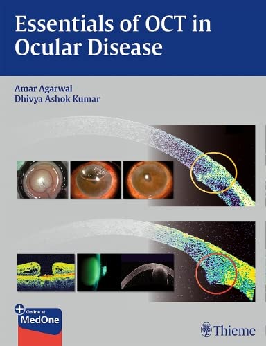 medical/ophthalmology/essentials-of-oct-in-ocular-diseases-1-ed-9781626230989