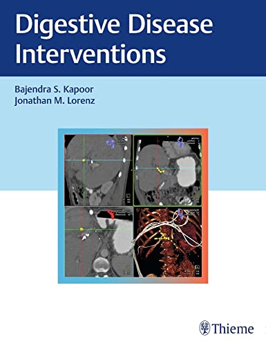 medical/radiology/digestive-disease-interventions-1-e-9781626233744