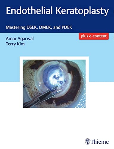 medical/ophthalmology/endothelial-keratoplasty-mastering-dsek-dmek-and-pdek-1-e-9781626234512