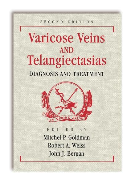 technical/general/varicose-veins-and-telangiectasias-diagnosis-and-treatment-second-edition-2-e-9781626235489