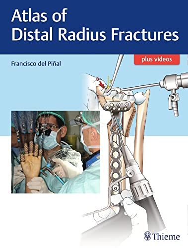 medical/orthopaedics/atlas-of-distal-radius-fractures-1-e-9781626236790