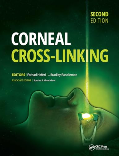 medical/ophthalmology/corneal-cross-linking-9781630912109