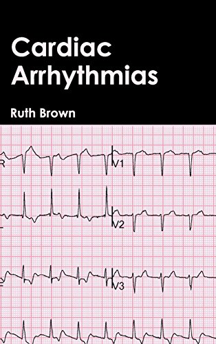 medical/cardiology/cardiac-arrhythmias-9781632410757