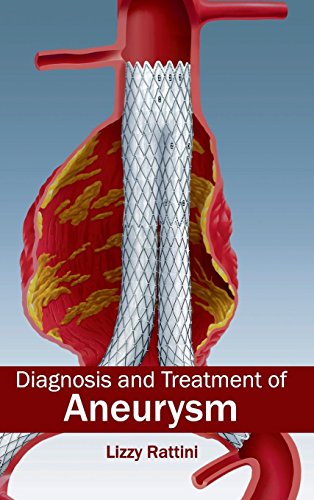 medical/cardiology/diagnosis-and-treatment-of-aneurysm-9781632411105